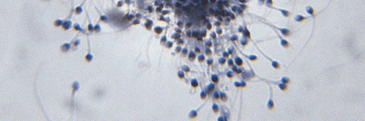 onde téléphone et fertilité masculine